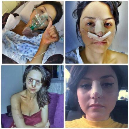 golpear brutalmente a su ex pareja