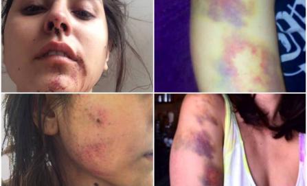 golpear brutalmente a su ex pareja