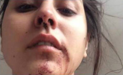 golpear brutalmente a su ex pareja