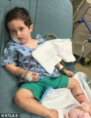 dos perros atacan sin control a un niño