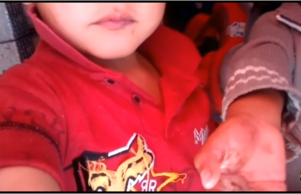 quema las manos de sus hijos