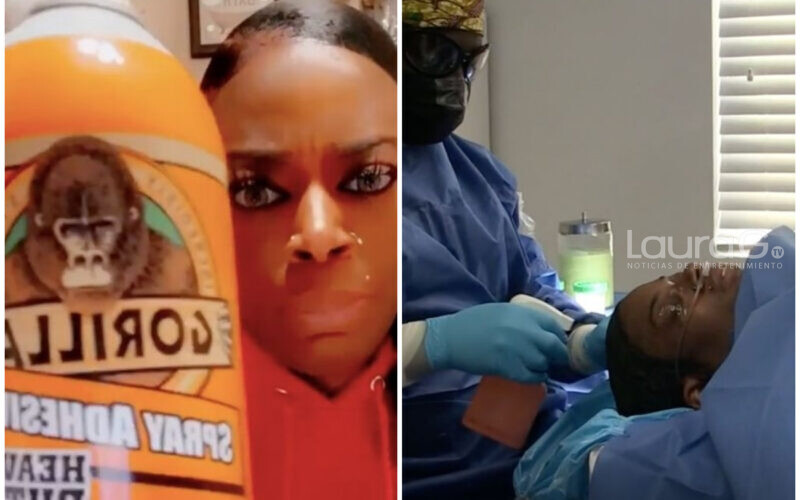 gorilla-pelo-pegamento-tessica