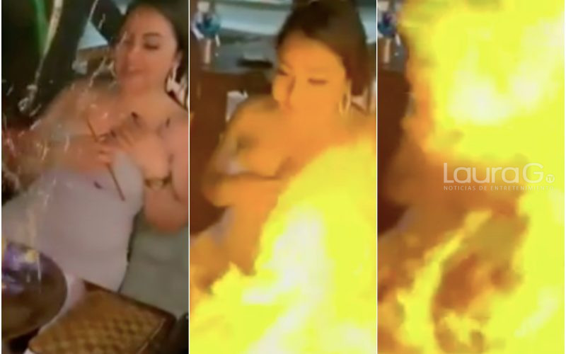 rostro-quemado-bebida-fuego