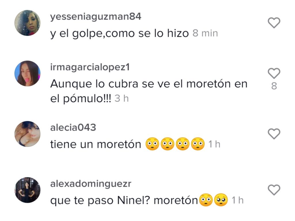 Comentarios Ninel Conde
